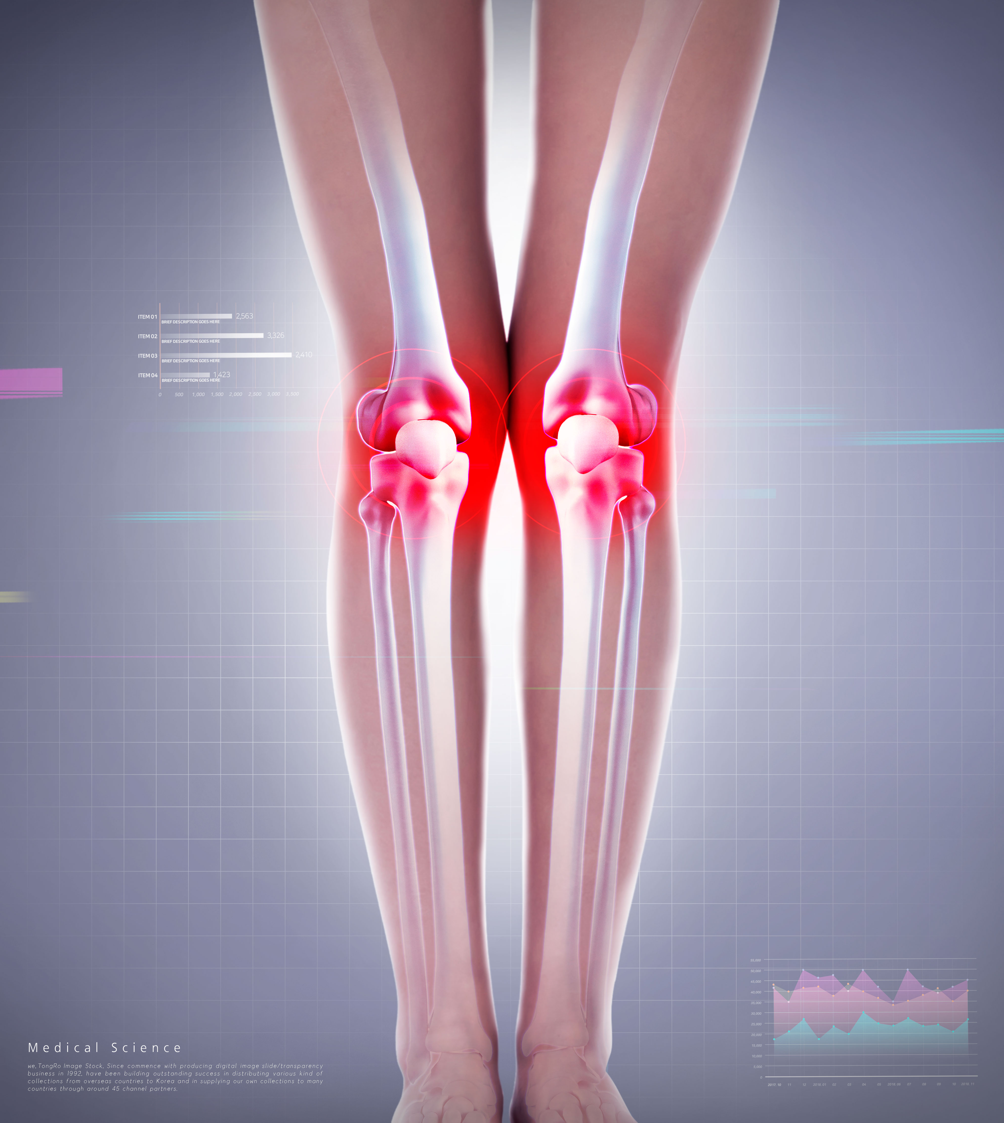 身体部位关节炎医学主题海报psd模板插图(2)