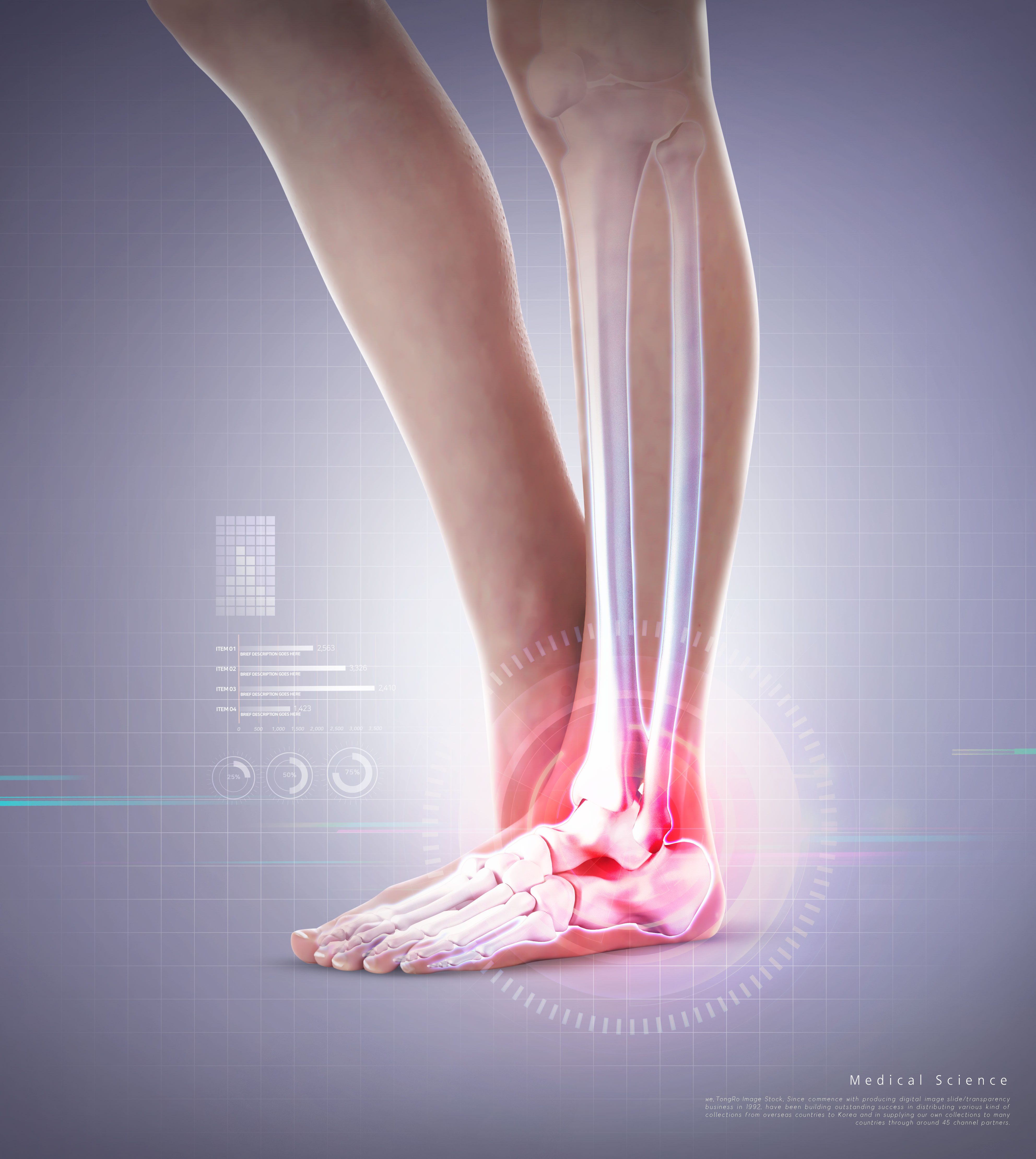 身体部位关节炎医学主题海报psd模板插图(5)