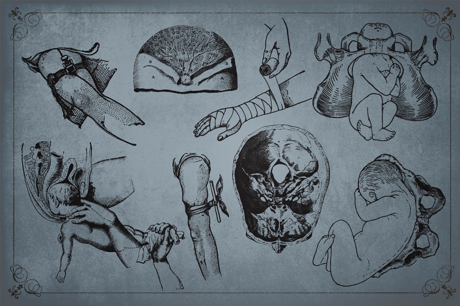 旧时代解剖医学插图素材 Medical Art | 110 EPS, PNG and JPG’s插图(4)