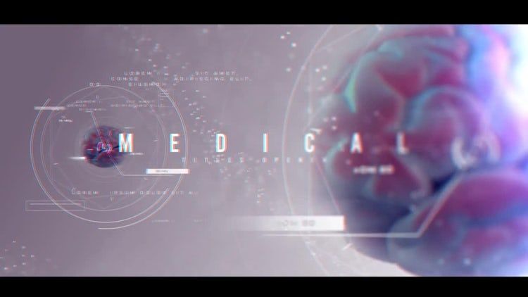 医用转场宣传ae模板